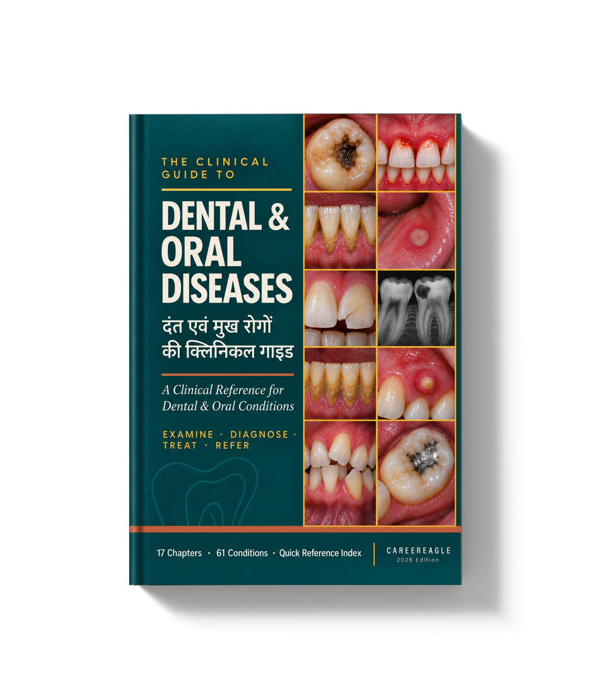 The Clinical Guide to Dental & Oral Diseases - हिंदी + English